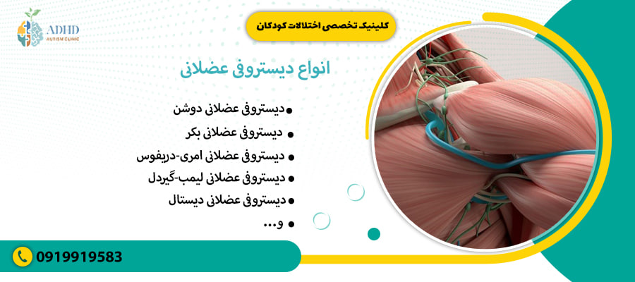 انواع دیستروفی عضلانی